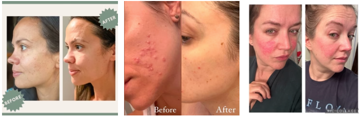If your skin reacts start here...